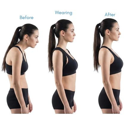 Back Brace Straightener