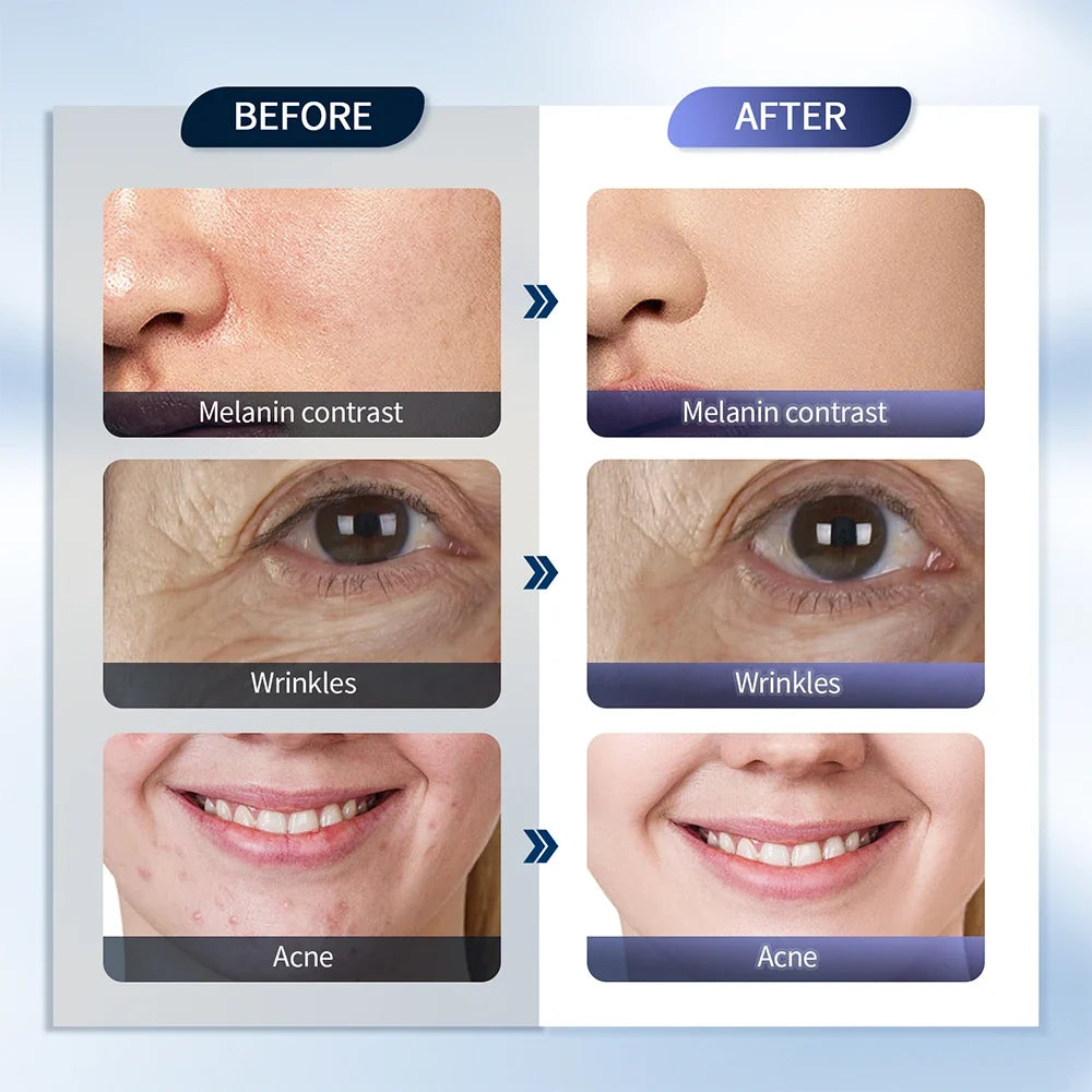 LED Photon Face Mask with Nano Mist Spray