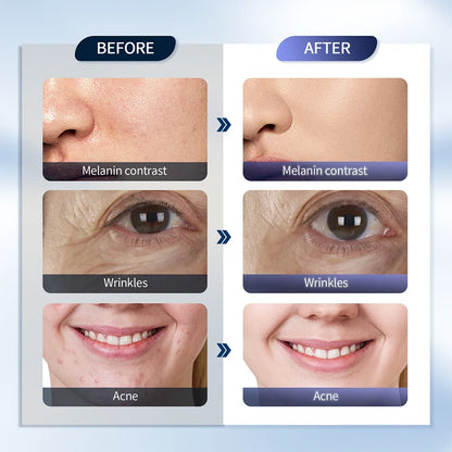 LED Photon Face Mask with Nano Mist Spray